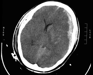 EM Lyceum ICH Questions